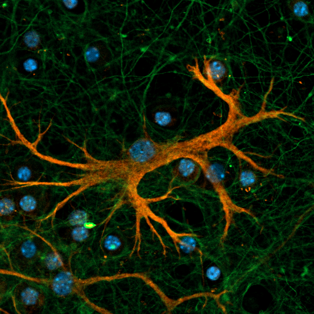 Нейроны, астроциты и ядра